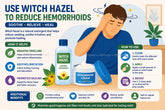 Cách chữa bệnh trĩ tại nhà bằng cây phỉ: 4 mẹo giảm đau ngứa tức thì