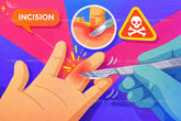 Cách chữa đau khớp ngón tay tại nhà: 3 phương pháp điều trị dứt điểm